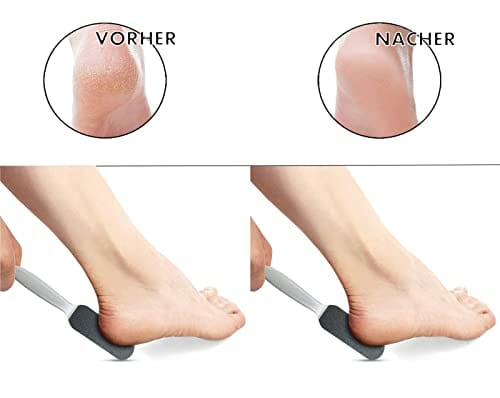 Pilnik do stóp, tarka do zrogowaciałego naskórka, dwustronny przyrząd do usuwania zrogowaciałego naskórka, pilnik do szorowania, tarka do stóp, tarka do zrogowaciałego naskórka, pielęgnacja stóp - obrazek 7