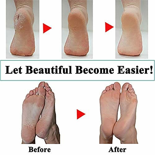 Mineralne wałki zastępcze, 10 sztuk zamienników głowicy kompatybilne z emjoi Micro Callous Remover dla niezwykle szorstkiej i wytrzymałej skóry.. - obrazek 3