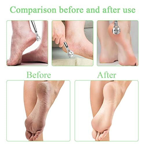 Pilarka do zrogowaciałego naskórka i usuwania zrogowaciałego naskórka, ergonomiczna, profesjonalna tarka do zrogowaciałego naskórka ze stali nierdzewnej, narzędzie do pielęgnacji stóp, z 10 zapasowymi ostrzami - obrazek 4