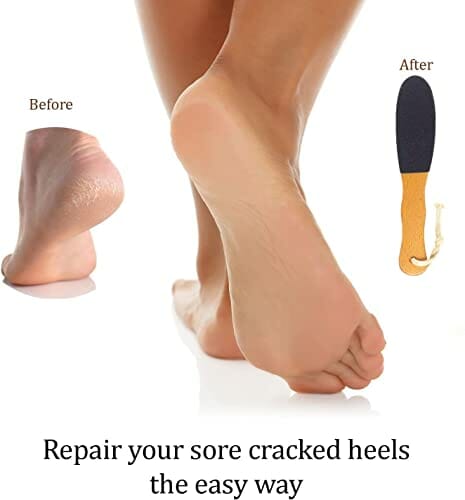 2 sztuki pilników do stóp, pilnik do stóp, do usuwania zrogowaciałego naskórka, przenośny pilnik do pielęgnacji stóp, do usuwania martwego zrogowaciałego naskórka i zrogowaciałego naskórka - obrazek 3