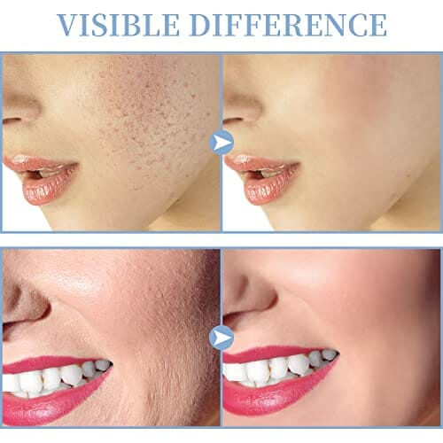 Maszyna do Twarzy o Wysokiej Częstotliwości - TUMAKOU Profesjonalna Pr - obrazek 4