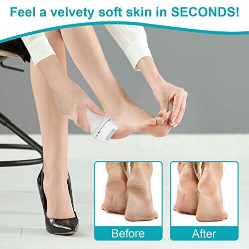 MYCARBON Elektryczny przyrząd do usuwania zrogowaciałego naskórka, z wyświetlaczem LED, 1200 mAh, do ponownego ładowania, elektryczny przyrząd do usuwania zrogowaciałego naskórka, z 2 zapasowymi rolkami, IPX5, wodoszczelny strug do pielęgnacji stóp, zestaw do pedicure - obrazek 6