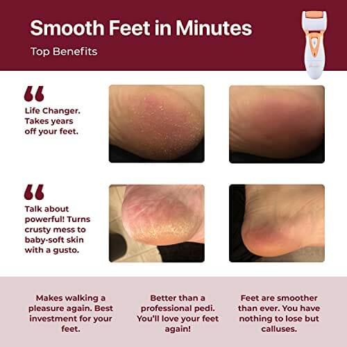 Elektryczne urządzenie do usuwania twardej skóry od Own Harmony – najlepszy oceniany profesjonalny środek do usuwania zrogowaciałego naskórka – do wielokrotnego ładowania pedicure i stóp z 3 dużymi rolkami zapasowymi do gładkich pięt - obrazek 7