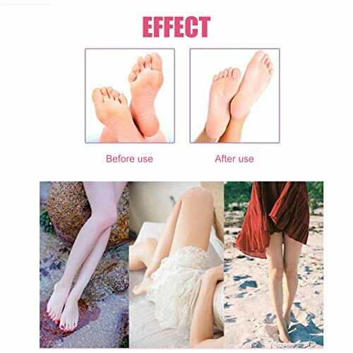 Elektryczny Kalus Stóp (czerwony), Profesjonalna Regulowana Maszyna do Pielęgnacji Stóp, Usuwanie Martwego Naskórka i Modzeli, 6,1 X 4,8 X 3,3 Cala (w Tym Podstawa) - obrazek 8