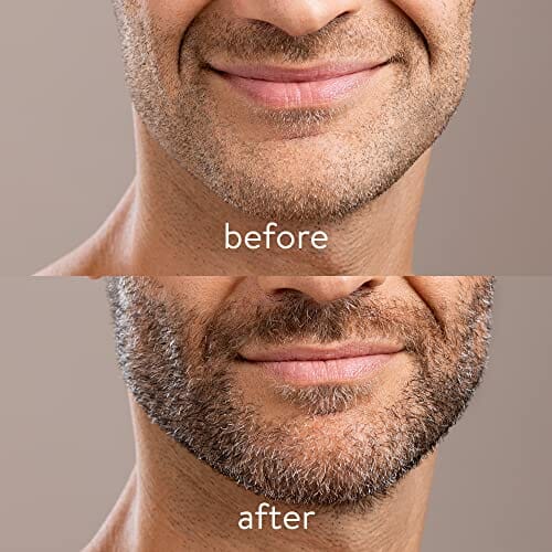 Navaris Wałek do brody - narzędzie do pielęgnacji porostu włosów na twarzy dla mężczyzn do włosów na twarzy - dermaroller dla mężczyzn do włosów na twarzy z pudełkiem do przechowywania - obrazek 5