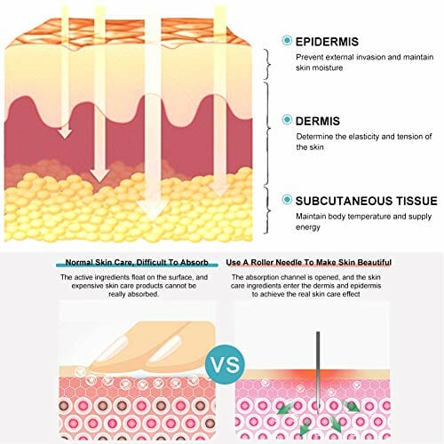 Dermaroller, 6 W 1 Micro Derma Roller, Masażer Do Pielęgnacji Skóry Trądzikowej, 0,5 Mm / 1 Mm / 1,5 Mm Opcjonalnie - obrazek 8